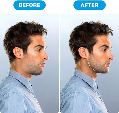 Chiseled Jawline Exerciser™