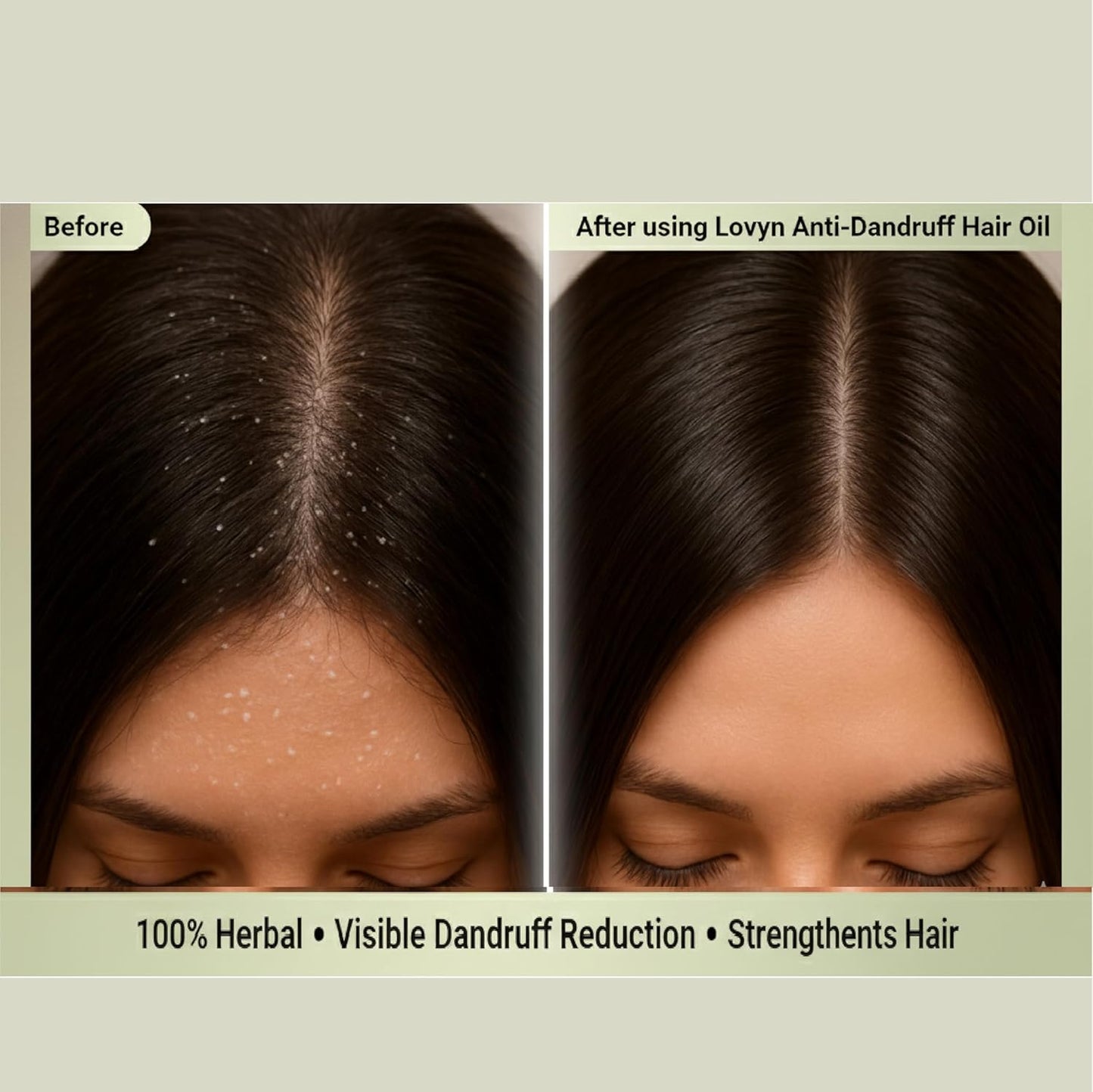 Herbal Dandruff Defense Oil™ (200ml)